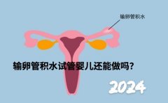 输卵管积水，试管还能做吗？别担心，专家告诉你这样做成功率更高！