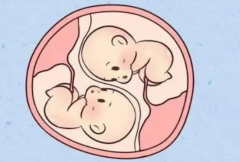 试管双胞胎成功率有多大，三代试管双胞胎的几率50%