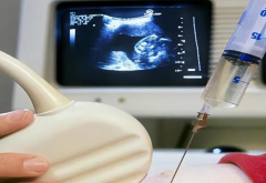 2024西安交大一附院试管全费用清单，助您明明白白备孕！