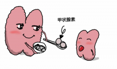 甲状腺激素水平偏高要警惕！可能影响试管成功着床，备孕前务必检查