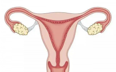 纵隔子宫能做双胞胎吗？五大风险一定要了解！