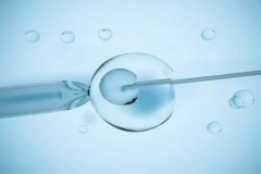 香港试管为什么和内地有差距，主要原因在于这四点