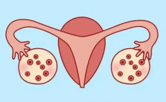 试管促排卵时，一定要注意这五大问题