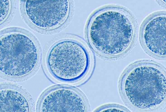 试管养囊的三大好处，为不孕不育夫妇带来生育希望