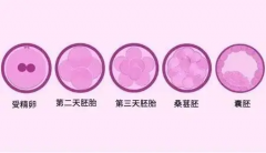 试管胚胎移植七大问题，想做试管的都建议了解！
