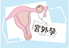 试管会导致宫外孕吗？囊胚移植后出血是否表示宫外孕