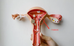 得了子宫腺肌症别急，试管能帮助你怀孕