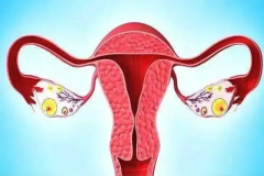 做试管前，宫腔粘连得先治，不然胚胎难着床！