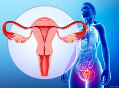 子宫肌瘤很常见，25%的人都会中招，但做试管还是有成功机会的！