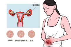 输卵管异常可以试试试管，比自然怀孕成功率高