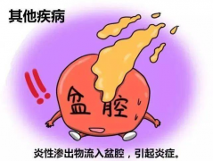 盆腔积液对试管有影响，手术时建议做好这些事