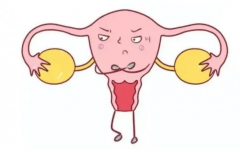 息肉影响怀孕，先做手术还是促排要看具体情况