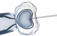 宁波三代试管包生'男'孩：透明化费用明细与节省技巧！