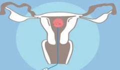 女性年过三十，怀孕就难上加难了吗？其实，突破生理与心理的难关才