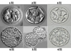 试管治疗中，哪些情况适合优先培养囊胚？有这4种情况的优先养囊！
