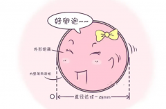 试管卵泡监测的三种方法，卵泡监测要做多少次？