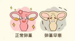 卵巢早衰要抓紧做试管，这些方法能帮助提高成功率