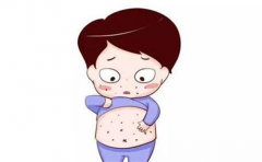 风疹病毒化验结果怎么看？三种结果表示什么含义？