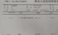 试管取卵前为什么要测测hCG？原因主要有三个