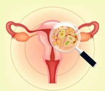 天生没有子宫影响寿命吗？平时怎么保养身体？