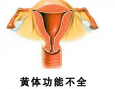 探析引发黄体功能不全的原因，日常调理建议这么做！