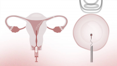 2025年合肥试管私立机构排名公布，看看哪家医院最适合你！