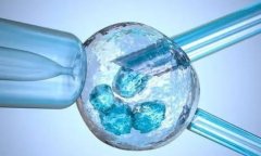 试管促排第三天，这些反应你中招了吗？