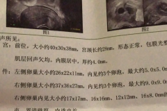 什么是试管一超二超三超检查？检查项目有哪些？