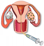 温州市人民医院试管专家推荐：寻找最适合您的试管治疗医生，深入了