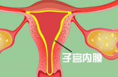 子宫内膜炎能做试管吗？治疗后有怀孕希望！