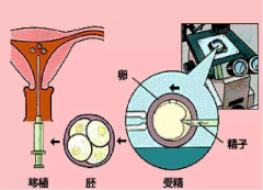 试管移植第七天，早孕试纸还没“报喜”？详解可能原因，助您保持理