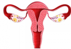 弓形子宫会导致试管着床困难，还有流产风险！