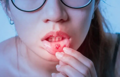 做完试管移植为什么经常口腔溃疡？应该怎么处理？