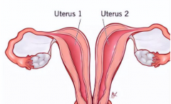 女性双子宫能尝试试管吗？有没有风险？