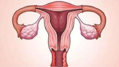 子宫畸形生育难题：试管技术能否带来新希望？