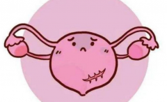 哪些原因导致女性子宫肌瘤？子宫肌瘤的症状是什么？
