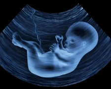 高龄做试管原来有这么多好处，很多人都不知道！