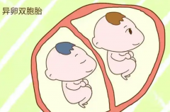 试管怀双胞胎有症状吗？早期有什么反应？