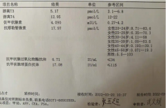 amh值和卵巢功能之间关系，看完就知道你能不能生育！