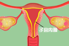 子宫内膜薄怎么做试管？患者分享成功经验！