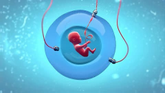 绝经女性可以做供卵试管，想成功须注意这些问题！