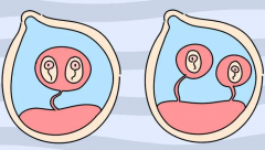 高龄且患有高血压，能否安全进行试管治疗？全面解析风险与注意事项