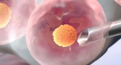 什么是促排攒卵？为什么高龄女性需要多次促排卵？