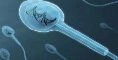 精子畸形率高怎么办？全面解析治疗方案，助你早日圆梦