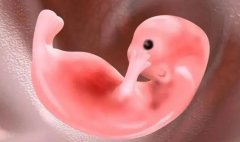 子宫腺肌症患者做试管：全面解析流程与注意事项！