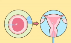 超过35岁的女性怀孕，对母体与胎儿可能带来的风险与影响有哪些：高龄