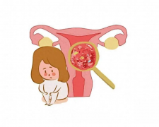 全面解析输卵管不通的检查项目：一步步揭开孕育难题的神秘面纱，助