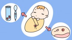 NK偏高，试管着床路上的绊脚石？科学解读影响