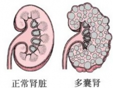 2025年上海长征医院多囊肾试管费用曝光，三代试管费用全解析