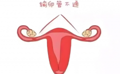 输卵管阻塞不用愁，试管技术圆您生育梦！